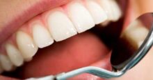 smalto per denti
